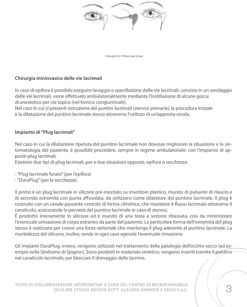 Nel caso in cui si presenti ostruzione dei puntini lacrimali (stenosi primaria), la procedura iniziale è la dilatazione del puntino lacrimale stesso attraverso l utilizzo di un apposita sonda.