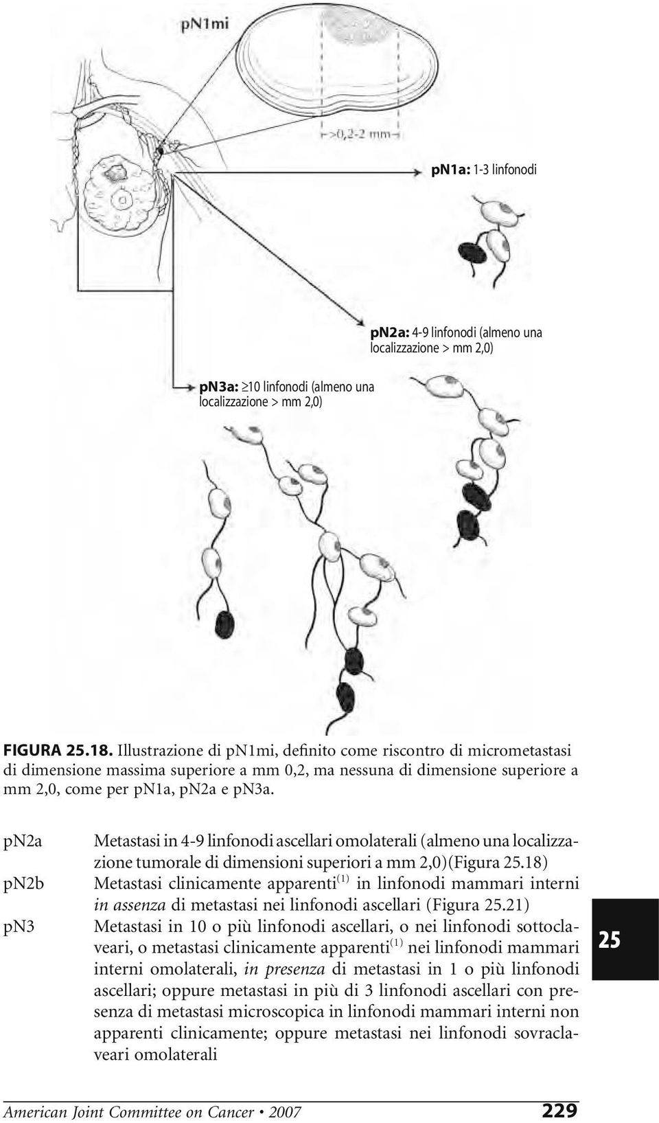 pn2a pn2b pn3 Metastasi in 4-9 linfonodi ascellari omolaterali (almeno una localizzazione tumorale di dimensioni superiori a mm 2,0)(Figura.