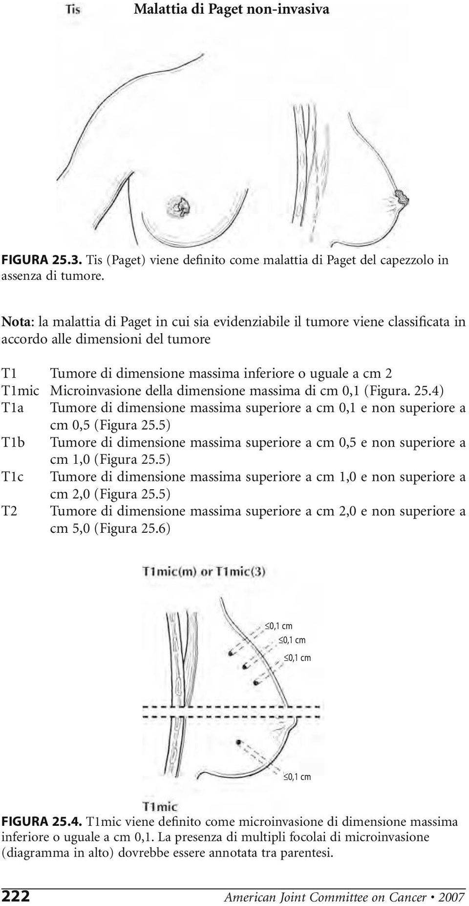 della dimensione massima di cm 0,1 (Figura..4) T1a Tumore di dimensione massima superiore a cm 0,1 e non superiore a cm 0,5 (Figura.