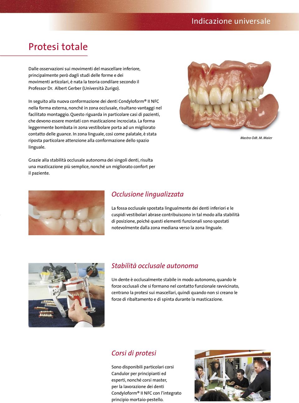 In seguito alla nuova conformazione dei denti Condyloform II NFC nella forma esterna, nonché in zona occlusale, risultano vantaggi nel facilitato montaggio.