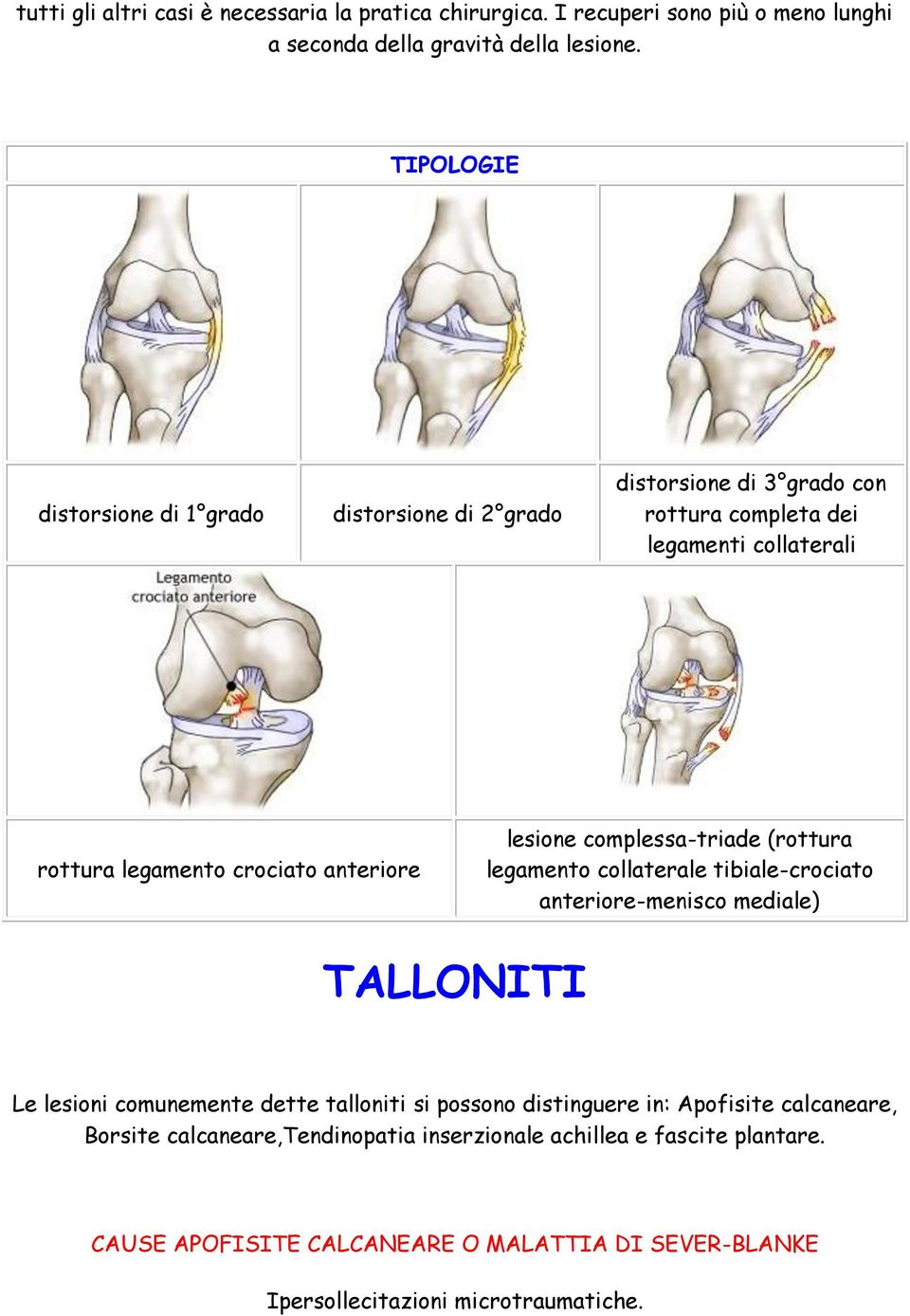 lesione complessa-triade (rottura legamento collaterale tibiale-crociato anteriore-menisco mediale) TALLONITI Le lesioni comunemente dette talloniti si possono