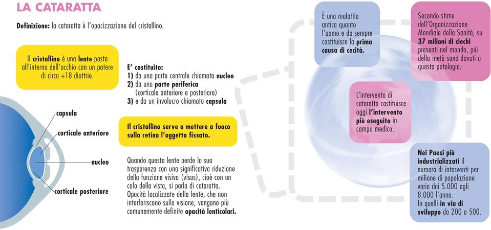 serve a mettere a fuoco sulla retina l oggetto fissato. È una malattia antica quanto l uomo e da sempre costituisce la prima causa di cecità.