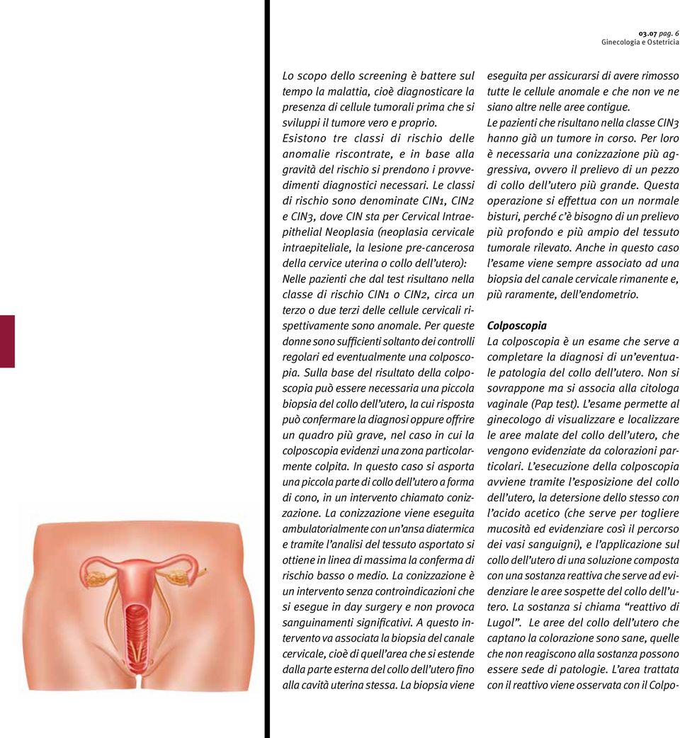 Le classi di rischio sono denominate CIN1, CIN2 e CIN3, dove CIN sta per Cervical Intraepithelial Neoplasia (neoplasia cervicale intraepiteliale, la lesione pre-cancerosa della cervice uterina o