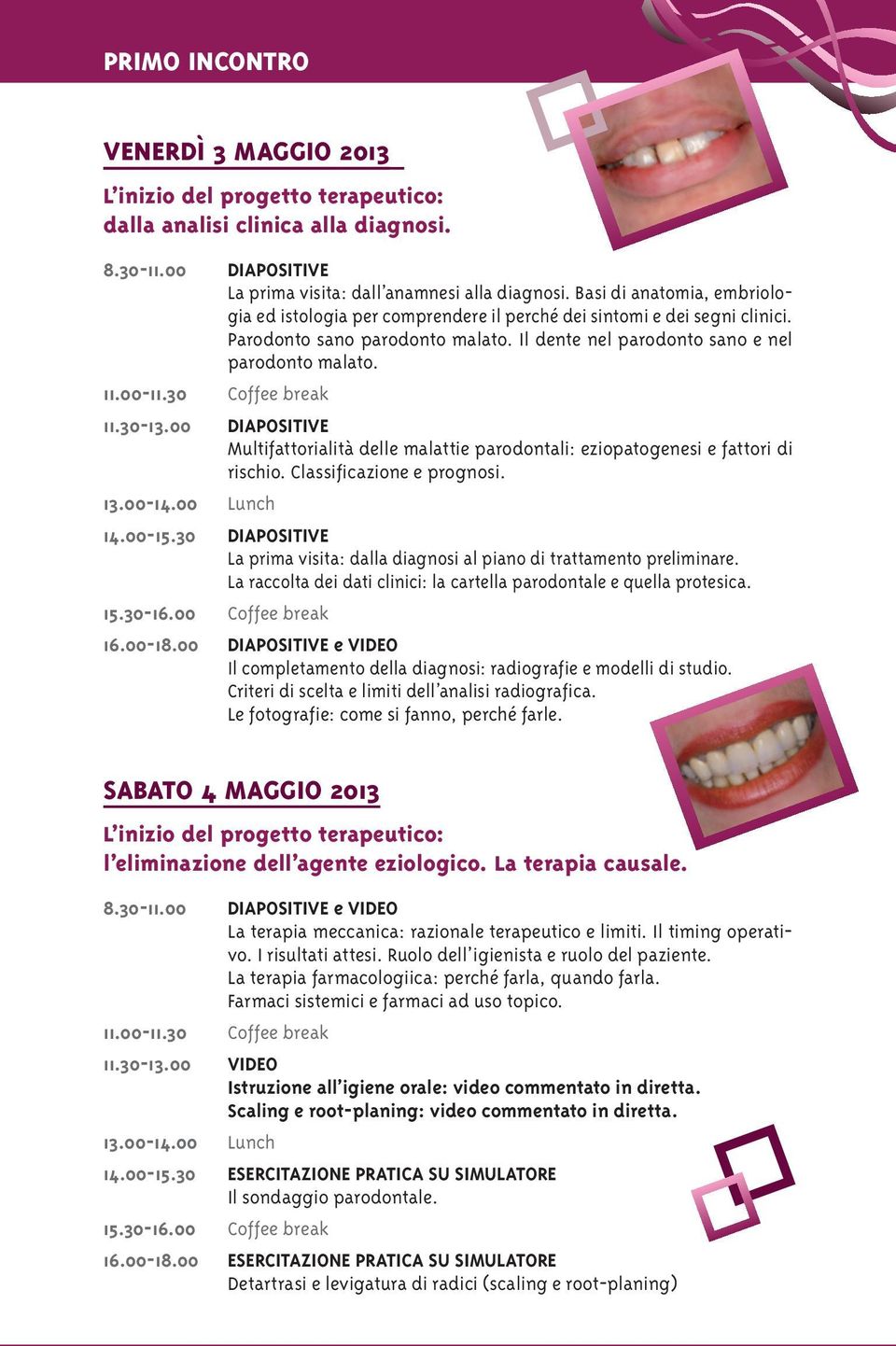 00 DIAPOSITIVE Multifattorialità delle malattie parodontali: eziopatogenesi e fattori di rischio. Classificazione e prognosi. 14.00-15.