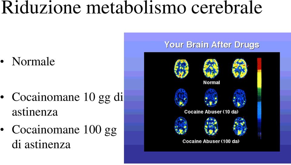 Cocainomane 10 gg di