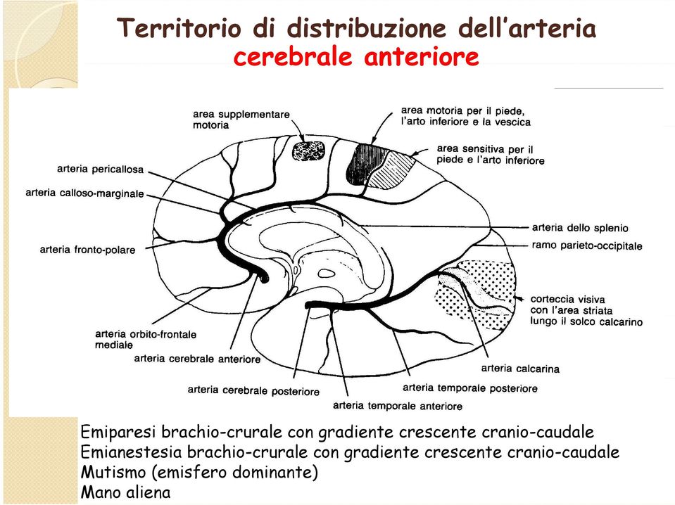 crescente cranio-caudale Emianestesia brachio-crurale con