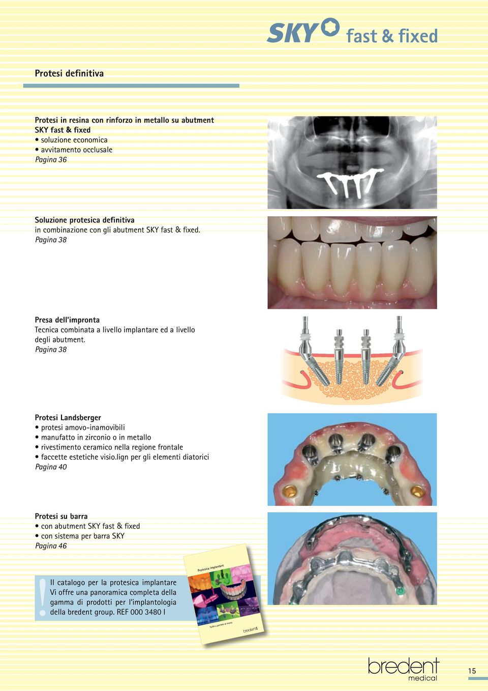 Pagina 38 Protesi Landsberger protesi amovo-inamovibili manufatto in zirconio o in metallo rivestimento ceramico nella regione frontale faccette estetiche visio.