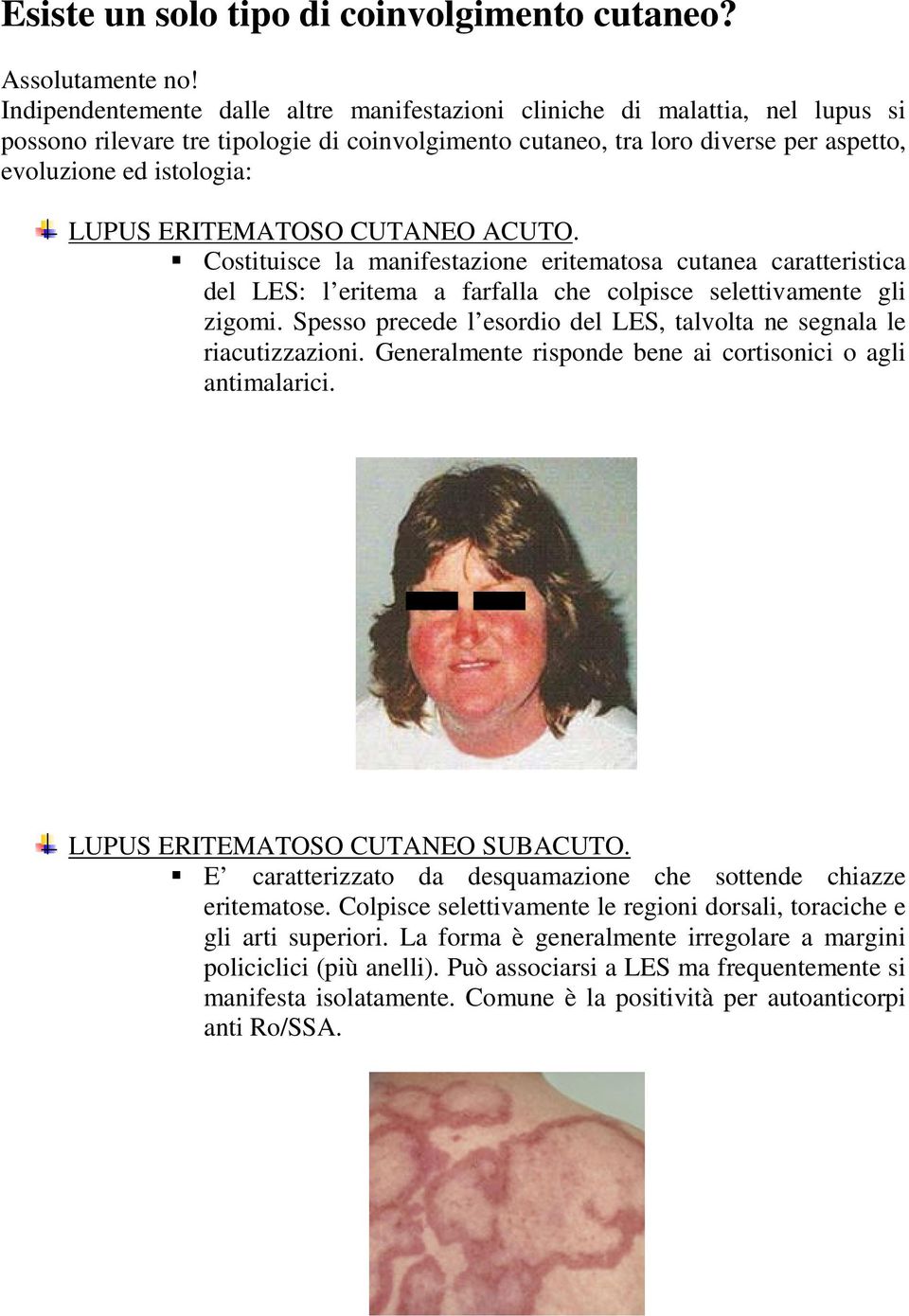 ERITEMATOSO CUTANEO ACUTO. Costituisce la manifestazione eritematosa cutanea caratteristica del LES: l eritema a farfalla che colpisce selettivamente gli zigomi.