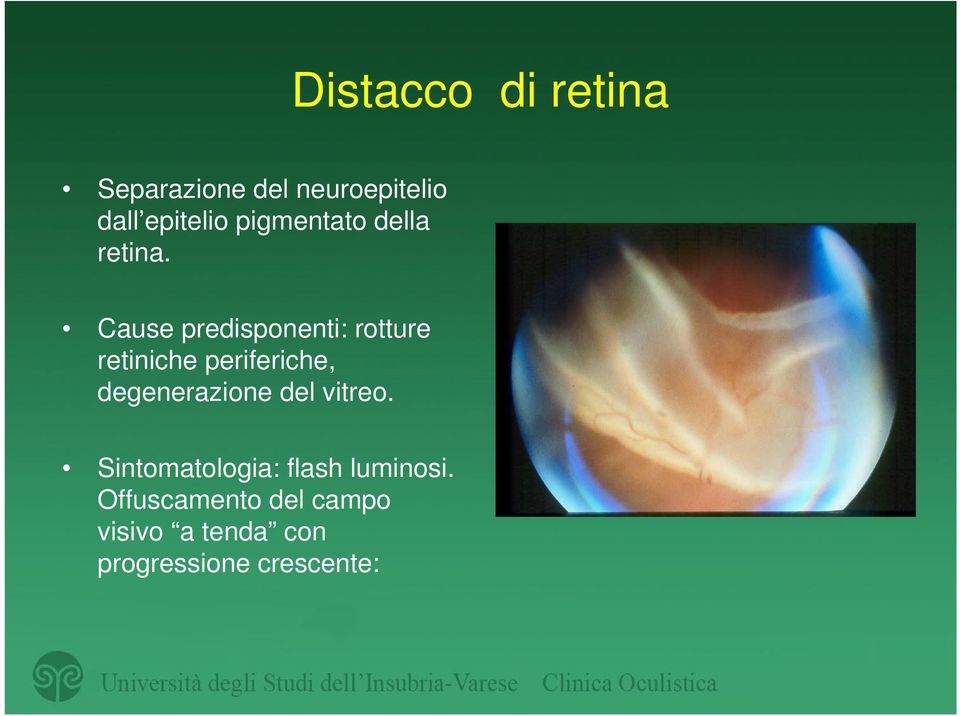 Cause predisponenti: rotture retiniche periferiche, degenerazione