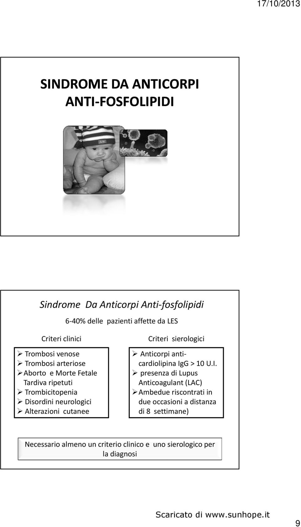 Alterazioni i cutanee Criteri sierologici Anticorpi anticardiolipina Ig