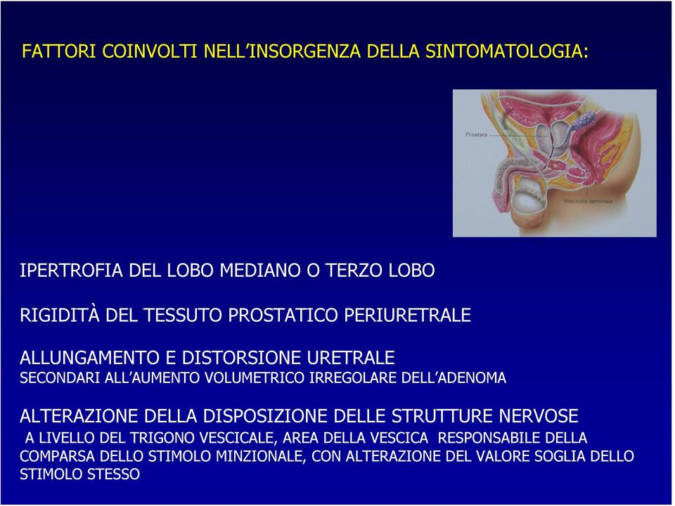 DELL ADENOMA ALTERAZIONE DELLA DISPOSIZIONE DELLE STRUTTURE NERVOSE A LIVELLO DEL TRIGONO VESCICALE, AREA DELLA