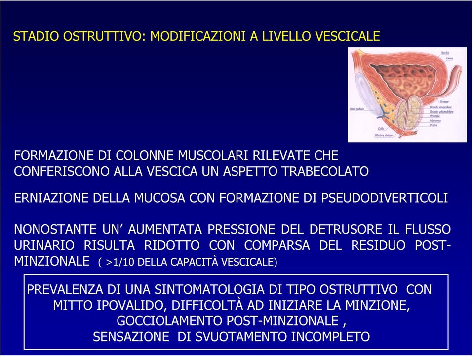 URINARIO RISULTA RIDOTTO CON COMPARSA DEL RESIDUO POST- MINZIONALE ( >1/10 DELLA CAPACITÀ VESCICALE) PREVALENZA DI UNA SINTOMATOLOGIA