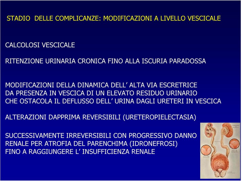 URINARIO CHE OSTACOLA IL DEFLUSSO DELL URINA DAGLI URETERI IN VESCICA ALTERAZIONI DAPPRIMA REVERSIBILI (URETEROPIELECTASIA)