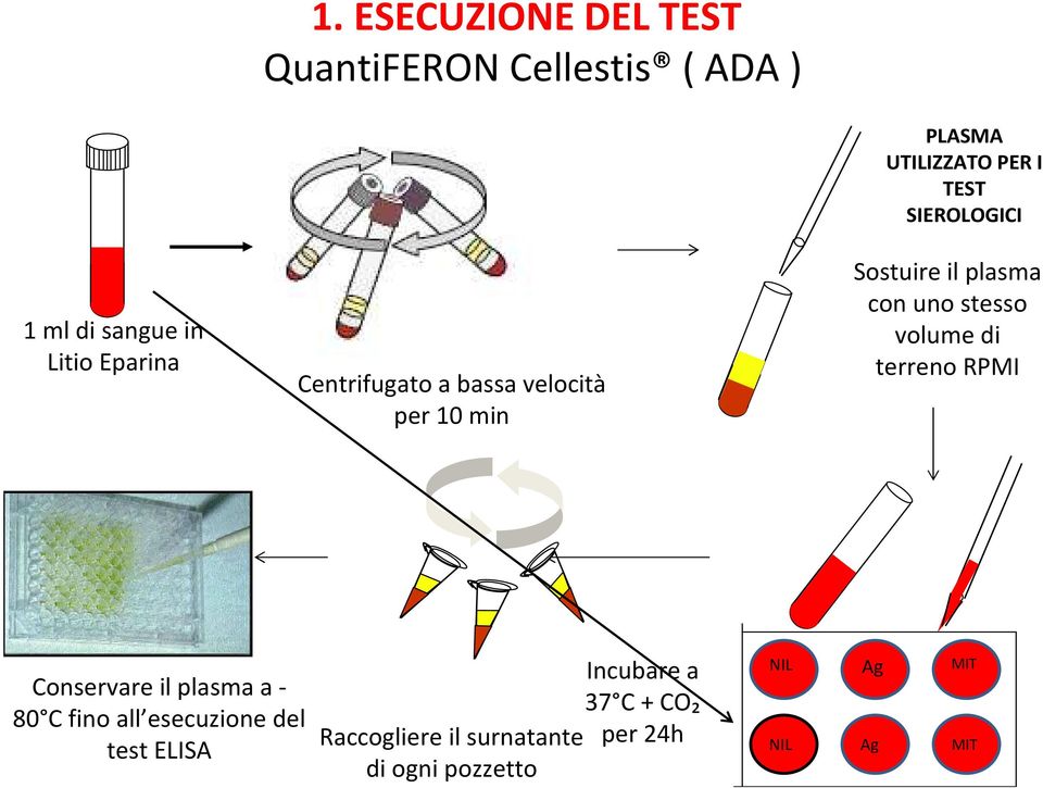 plasma con uno stesso volume di terreno RPMI Conservare il plasma a - 80 C fino all esecuzione