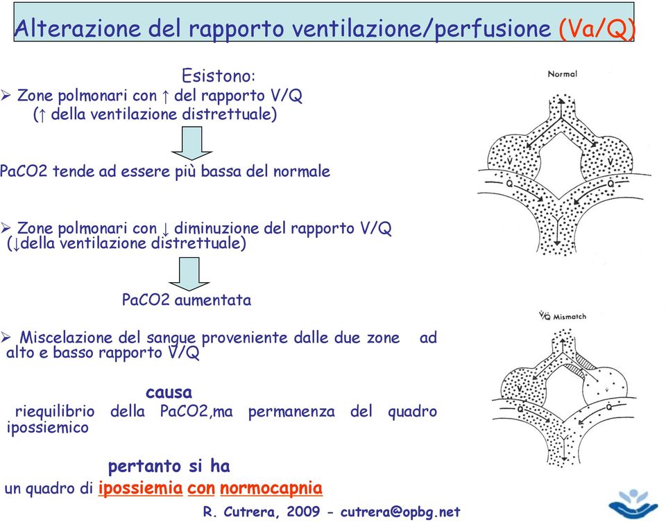 Zone polmonari con " diminuzione del rapporto V/Q ("della ventilazione distrettuale) PaCO2 aumentata!