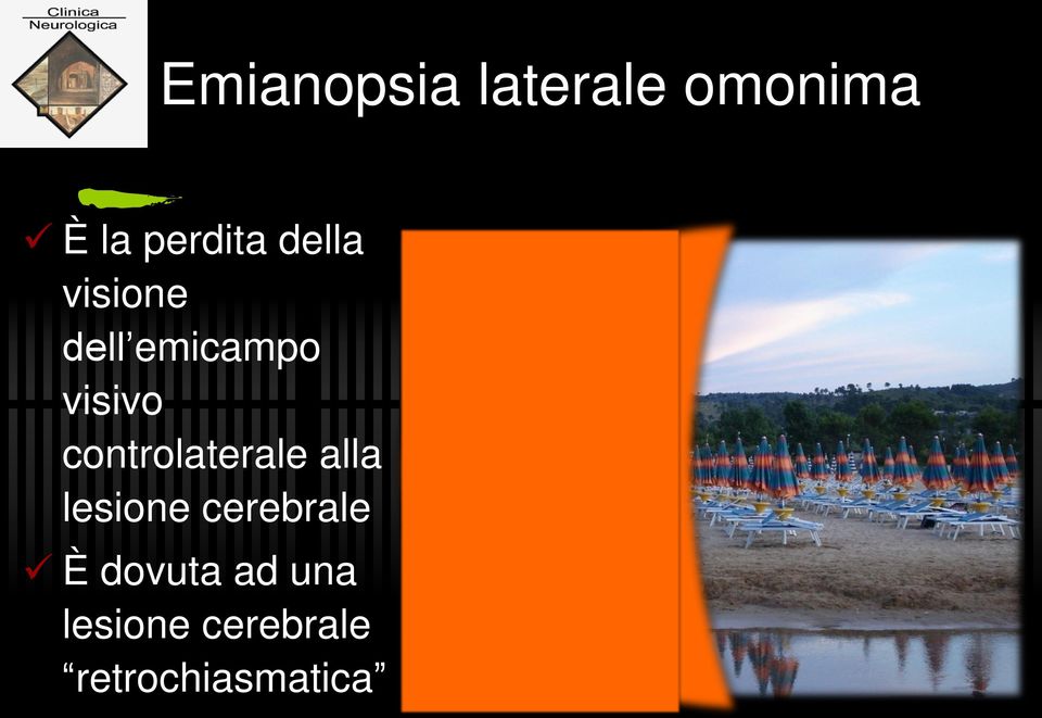 controlaterale alla lesione cerebrale È