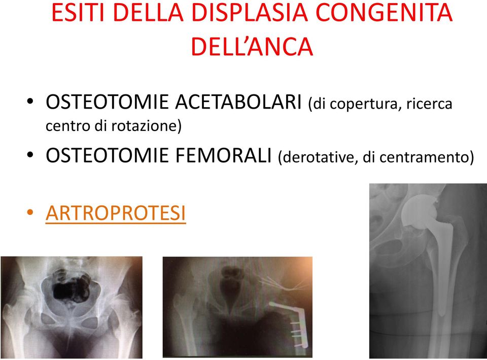 ricerca centro di rotazione) OSTEOTOMIE