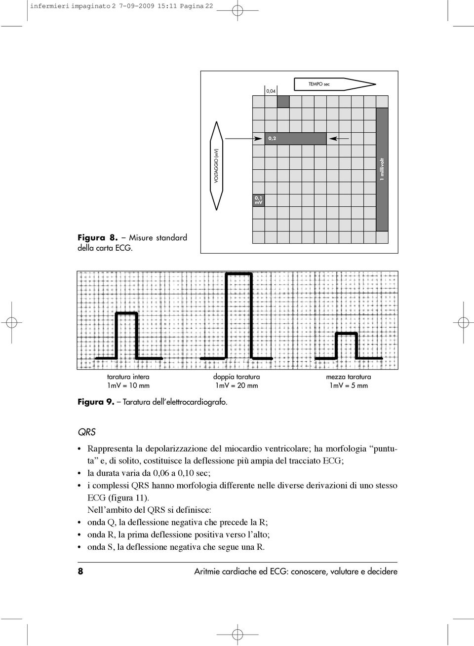 QRS Rappresenta la depolarizzazione del miocardio ventricolare; ha morfologia puntuta e, di solito, costituisce la deflessione più ampia del tracciato ECG; la durata varia da 0,06 a 0,10 sec; i