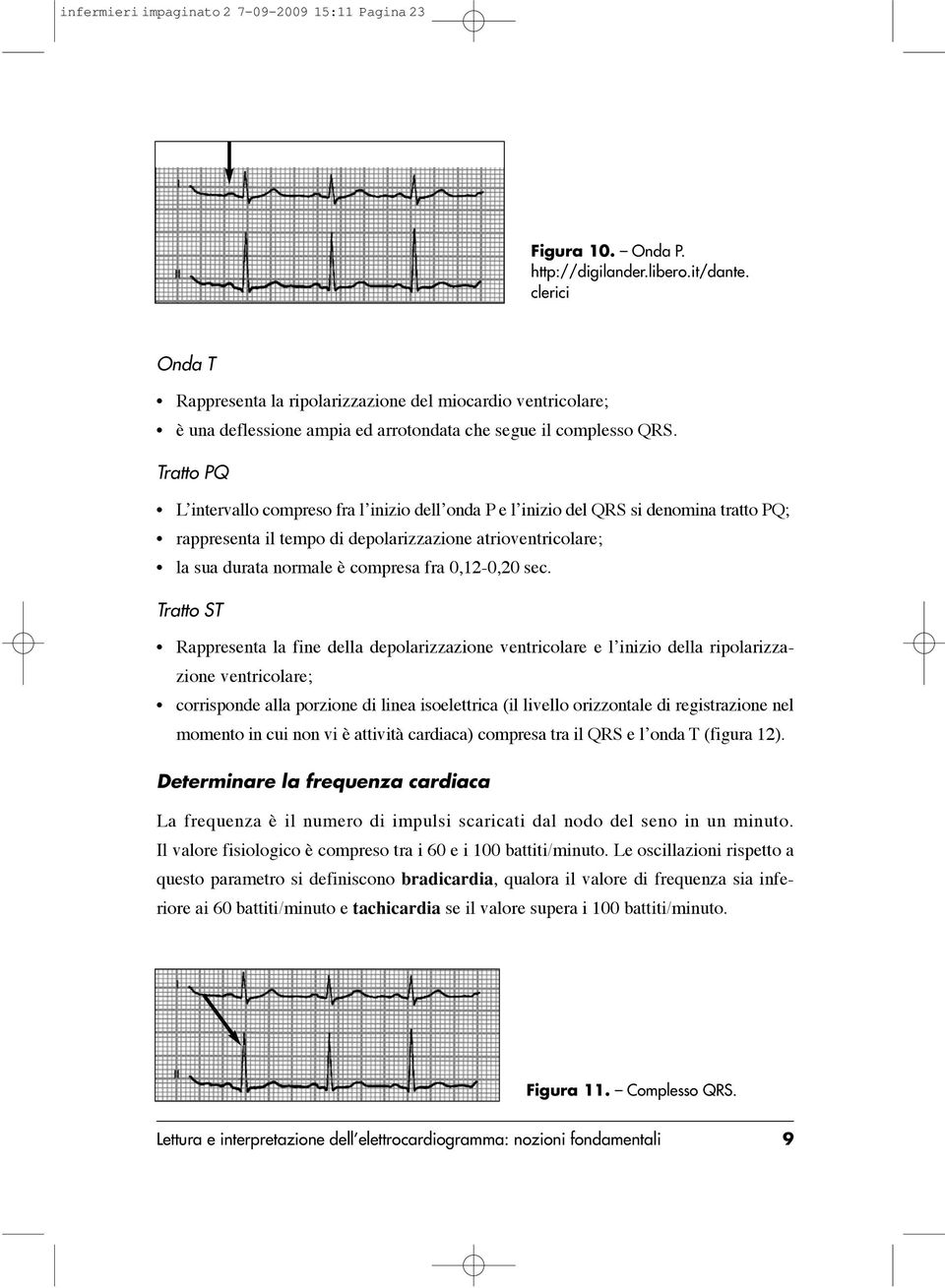 Tratto PQ L intervallo compreso fra l inizio dell onda P e l inizio del QRS si denomina tratto PQ; rappresenta il tempo di depolarizzazione atrioventricolare; la sua durata normale è compresa fra