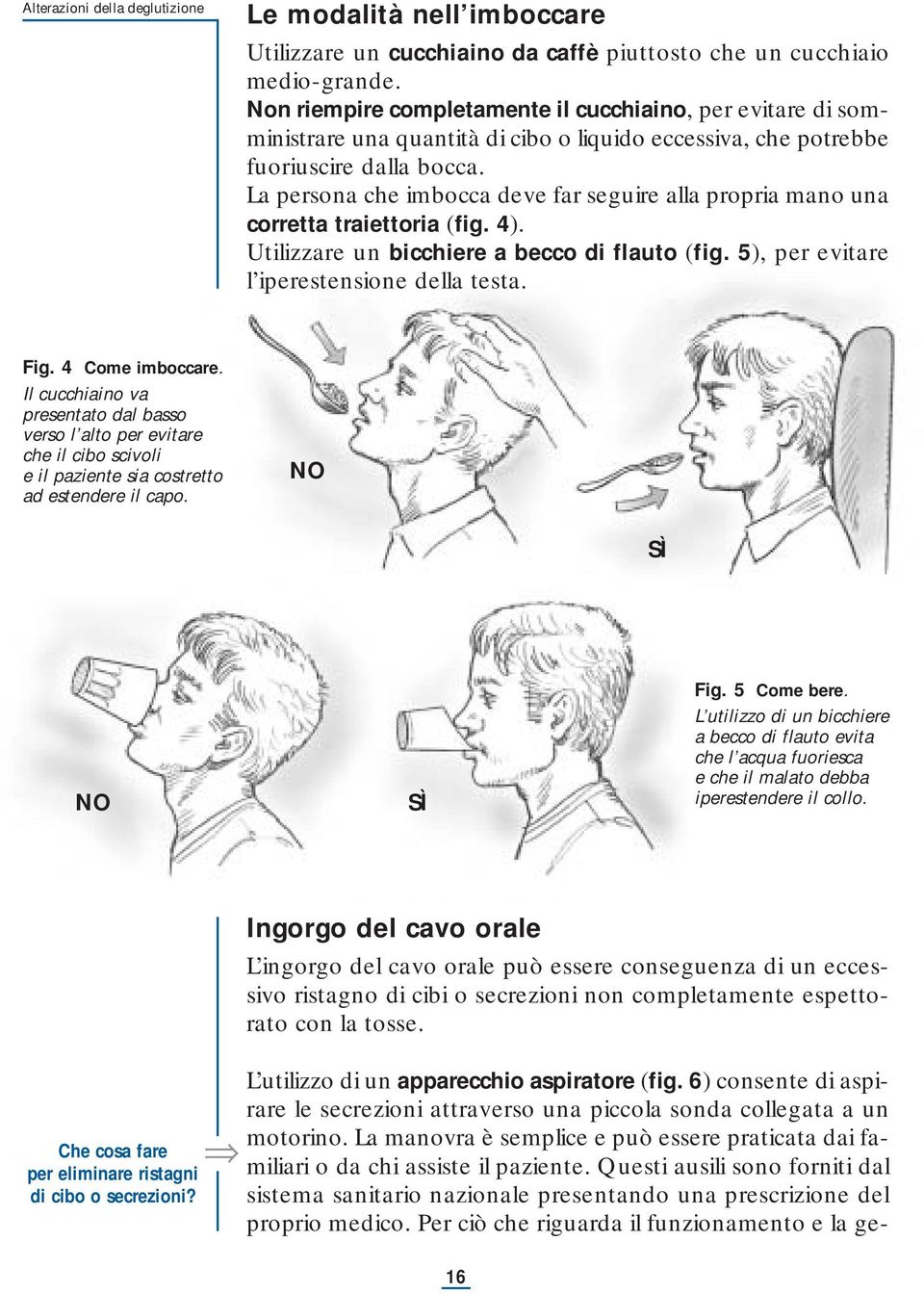 La persona che imbocca deve far seguire alla propria mano una corretta traiettoria (fig. 4). Utilizzare un bicchiere a becco di flauto (fig. 5), per evitare l iperestensione della testa. Fig.