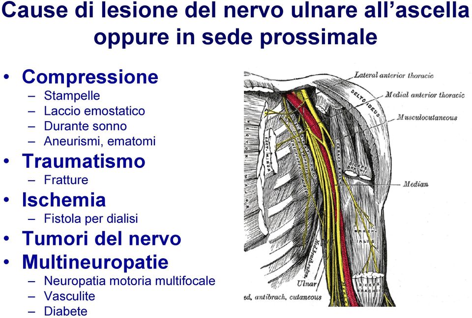 Aneurismi, ematomi Traumatismo Fratture Ischemia Fistola per dialisi