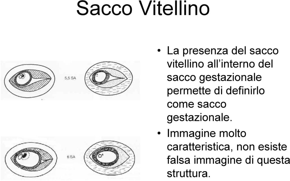 definirlo come sacco gestazionale.