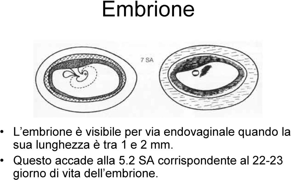 1 e 2 mm. Questo accade alla 5.