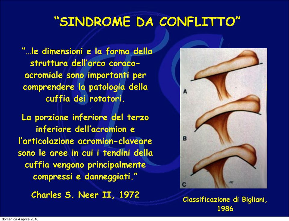 La porzione inferiore del terzo inferiore dell acromion e l articolazione acromion-claveare sono le