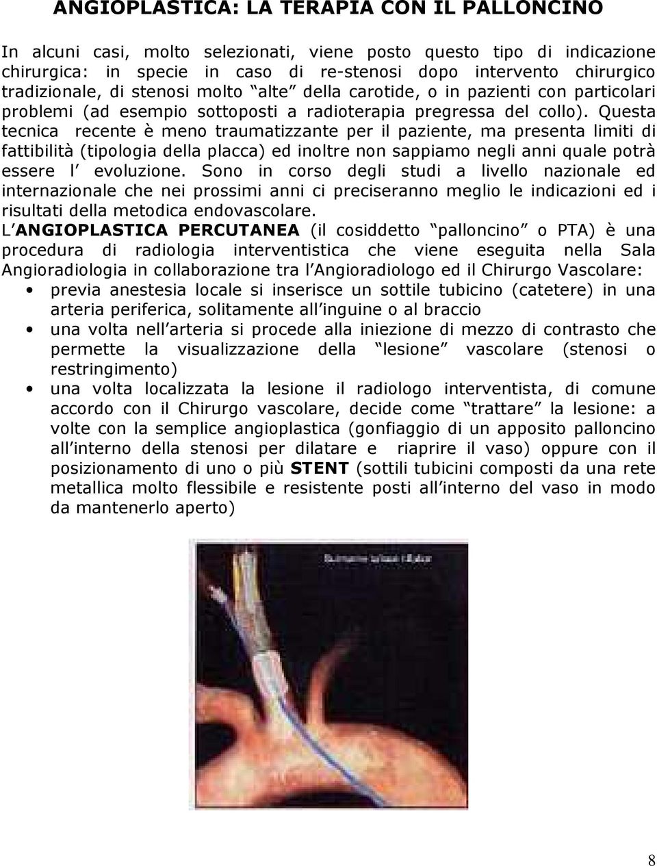 Questa tecnica recente è meno traumatizzante per il paziente, ma presenta limiti di fattibilità (tipologia della placca) ed inoltre non sappiamo negli anni quale potrà essere l evoluzione.