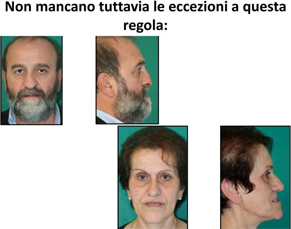 eccezioni a