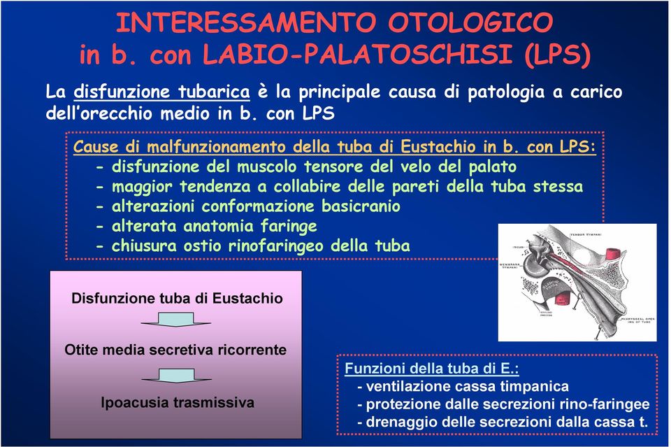 con LPS: - disfunzione del muscolo tensore del velo del palato - maggior tendenza a collabire delle pareti della tuba stessa - alterazioni conformazione basicranio -