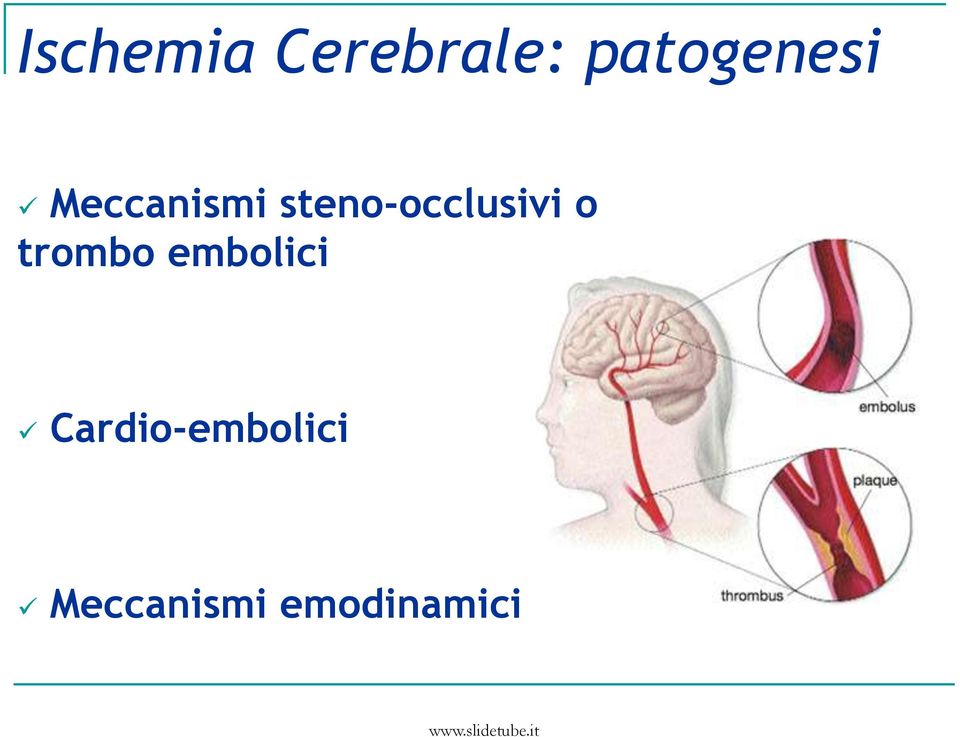 steno-occlusivi o trombo