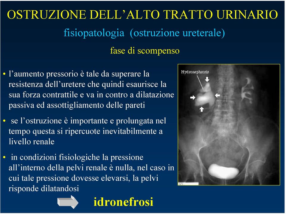 pareti se l ostruzione è importante e prolungata nel tempo questa si ripercuote inevitabilmente a livello renale in condizioni