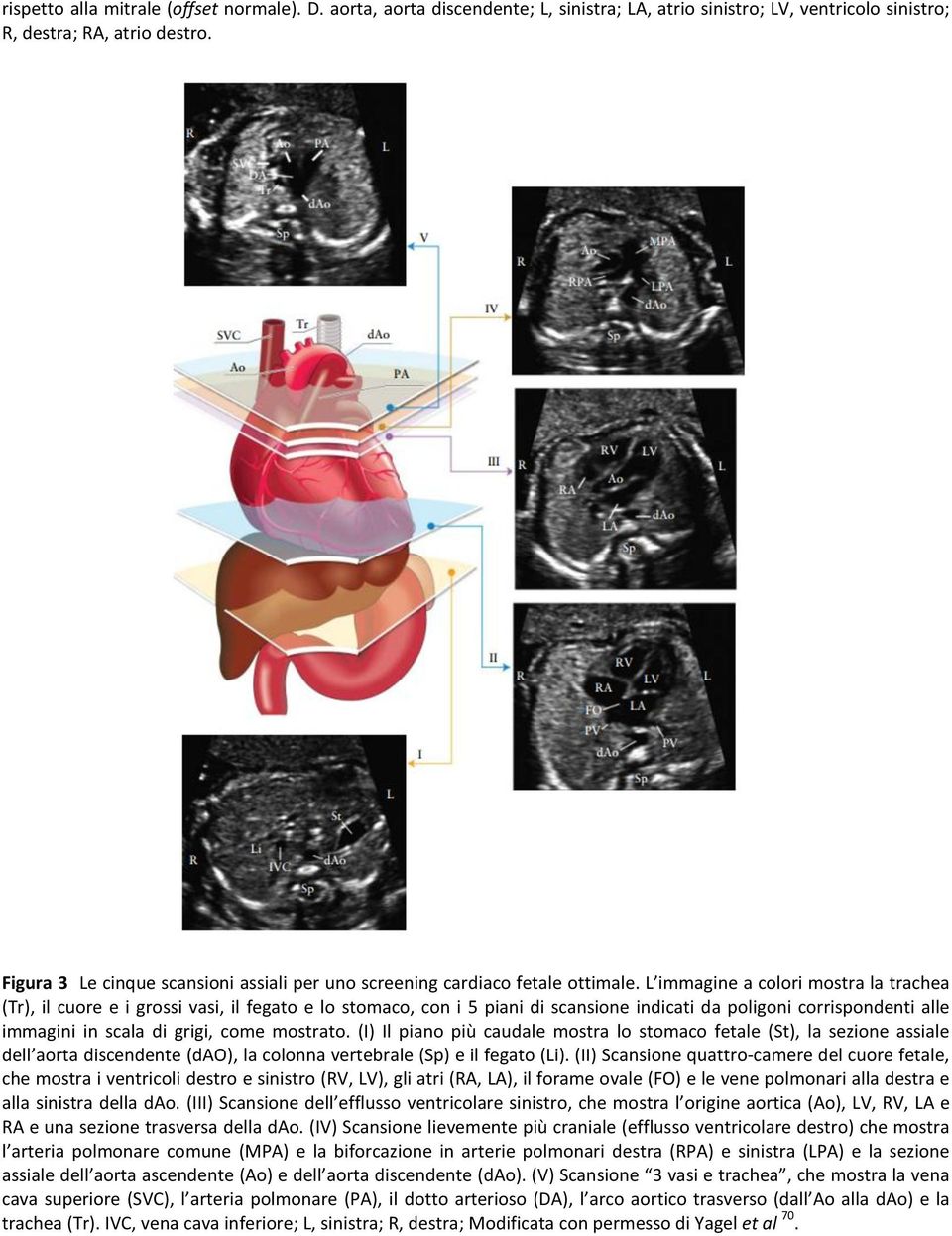 L immagine a colori mostra la trachea (Tr), il cuore e i grossi vasi, il fegato e lo stomaco, con i 5 piani di scansione indicati da poligoni corrispondenti alle immagini in scala di grigi, come