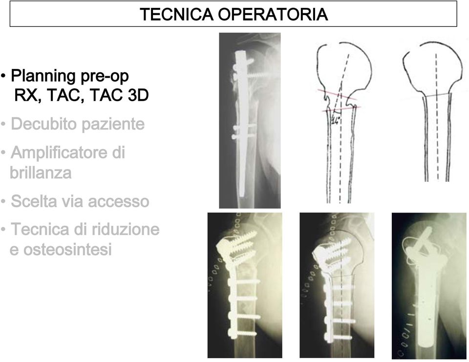 Amplificatore di brillanza Scelta via