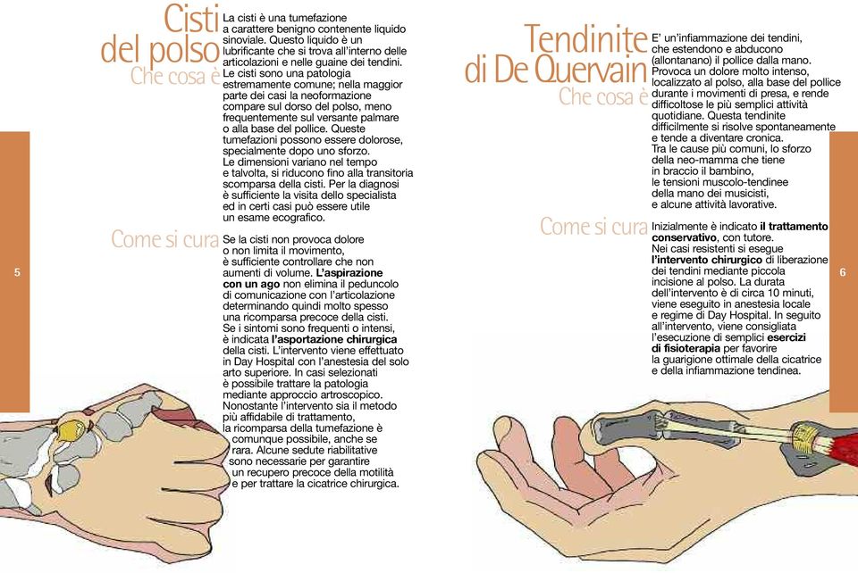 Queste tumefazioni possono essere dolorose, specialmente dopo uno sforzo. Le dimensioni variano nel tempo e talvolta, si riducono fino alla transitoria scomparsa della cisti.