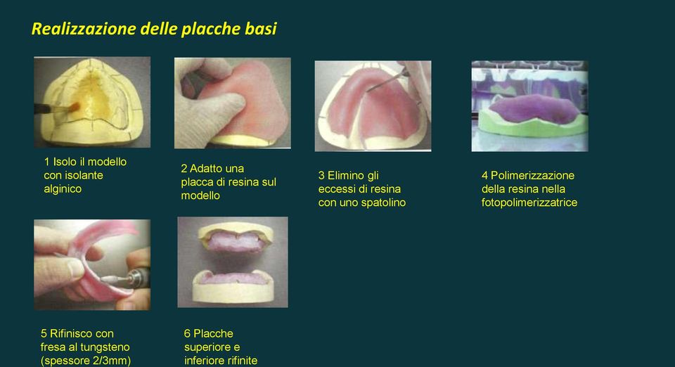 spatolino 4 Polimerizzazione della resina nella fotopolimerizzatrice 5