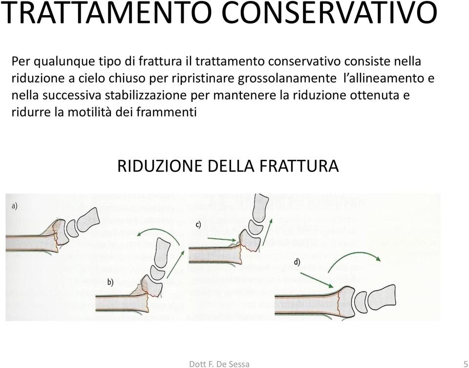 grossolanamente l allineamento e nella successiva stabilizzazione per mantenere