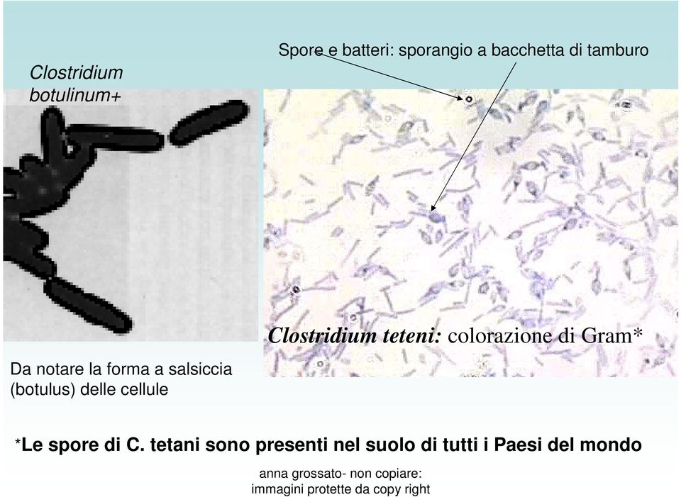 (botulus) delle cellule Clostridium teteni: colorazione di