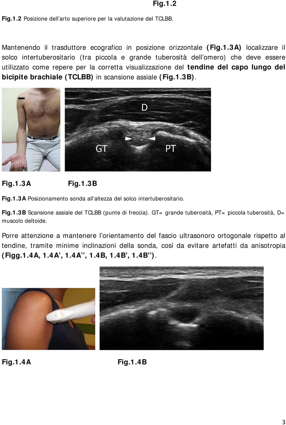 Mantenendo il trasduttore ecografico in posizione orizzontale (3A) localizzare il solco intertuberositario (tra piccola e grande tuberosità dell omero) che deve essere utilizzato come repere per la