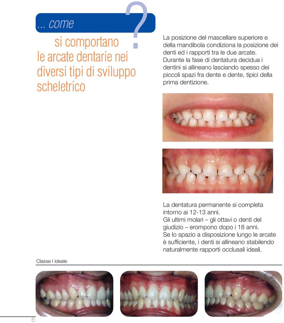 Durante la fase di dentatura decidua i dentini si allineano lasciando spesso dei piccoli spazi fra dente e dente, tipici della prima dentizione.