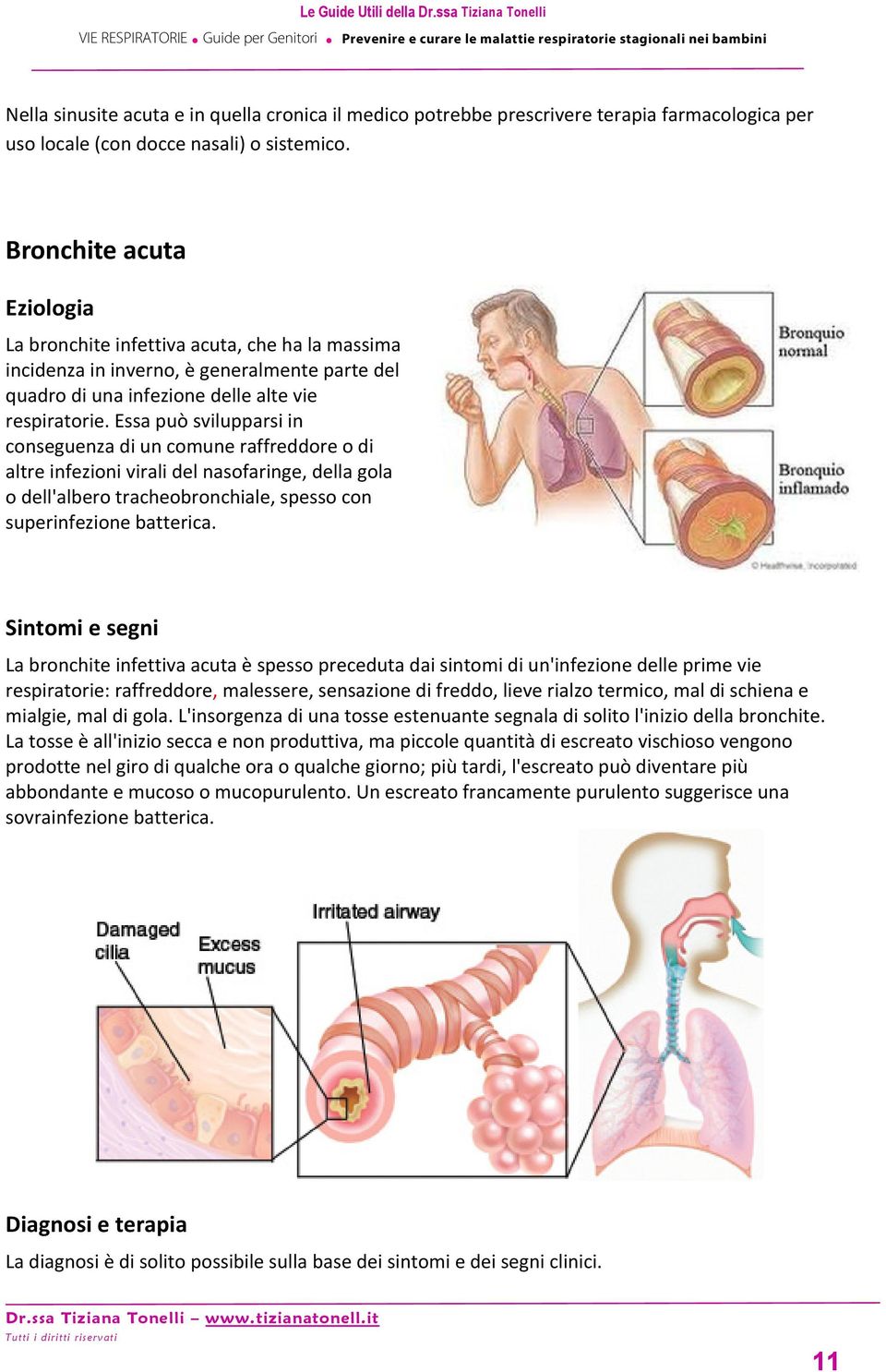 Essa può svilupparsi in conseguenza di un comune raffreddore o di altre infezioni virali del nasofaringe, della gola o dell'albero tracheobronchiale, spesso con superinfezione batterica.