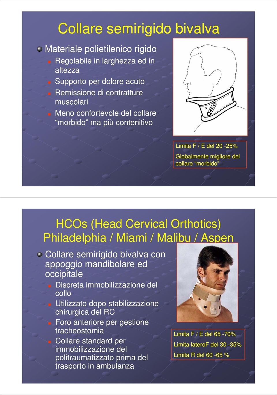 Collare semirigido i id bivalva con appoggio mandibolare ed occipitale Discreta immobilizzazione del collo Utilizzato dopo stabilizzazione chirurgica del RC Foro anteriore per