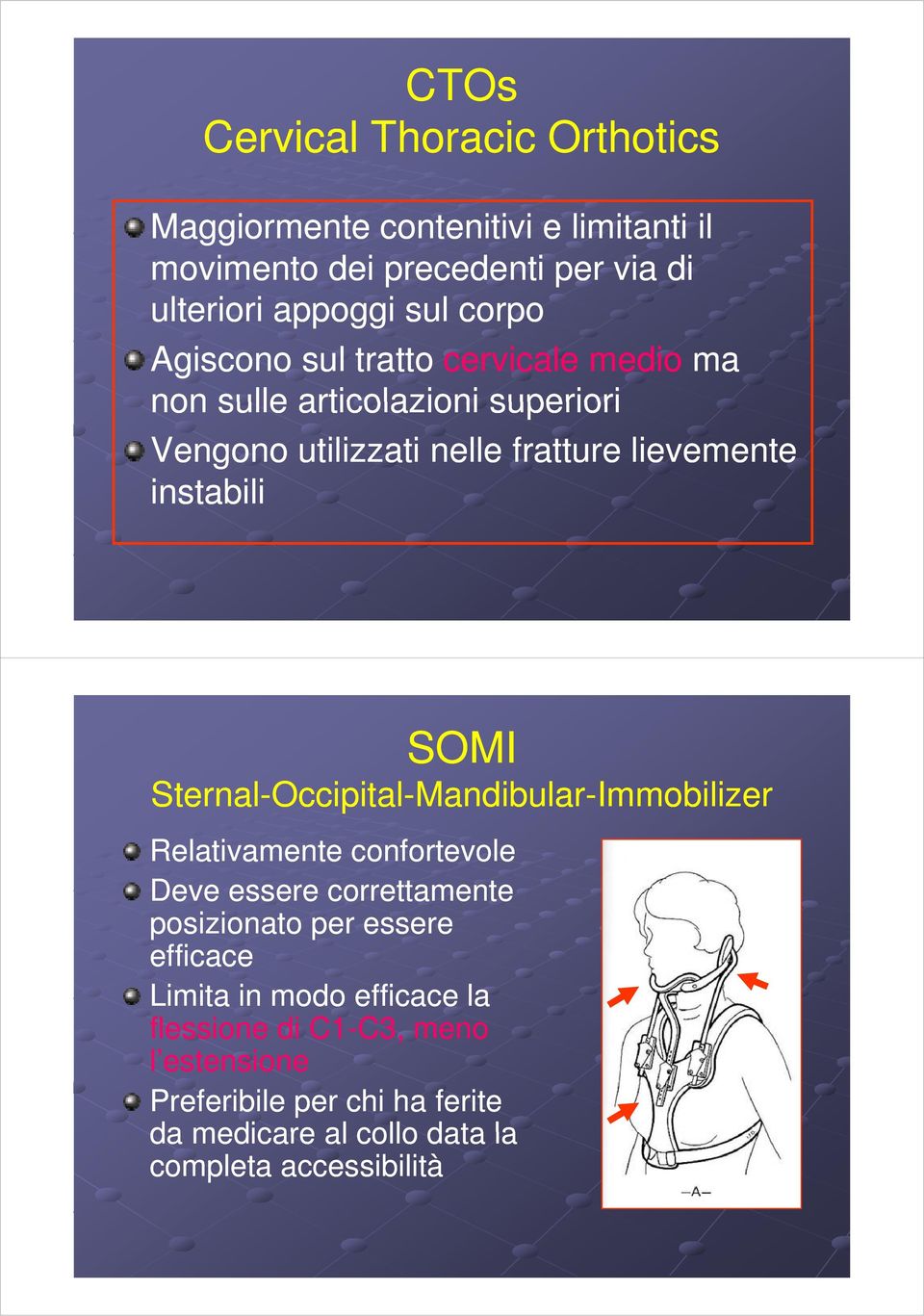 Sternal-Occipital-Mandibular-Immobilizer Relativamente t confortevole Deve essere correttamente posizionato i per essere efficace Limita