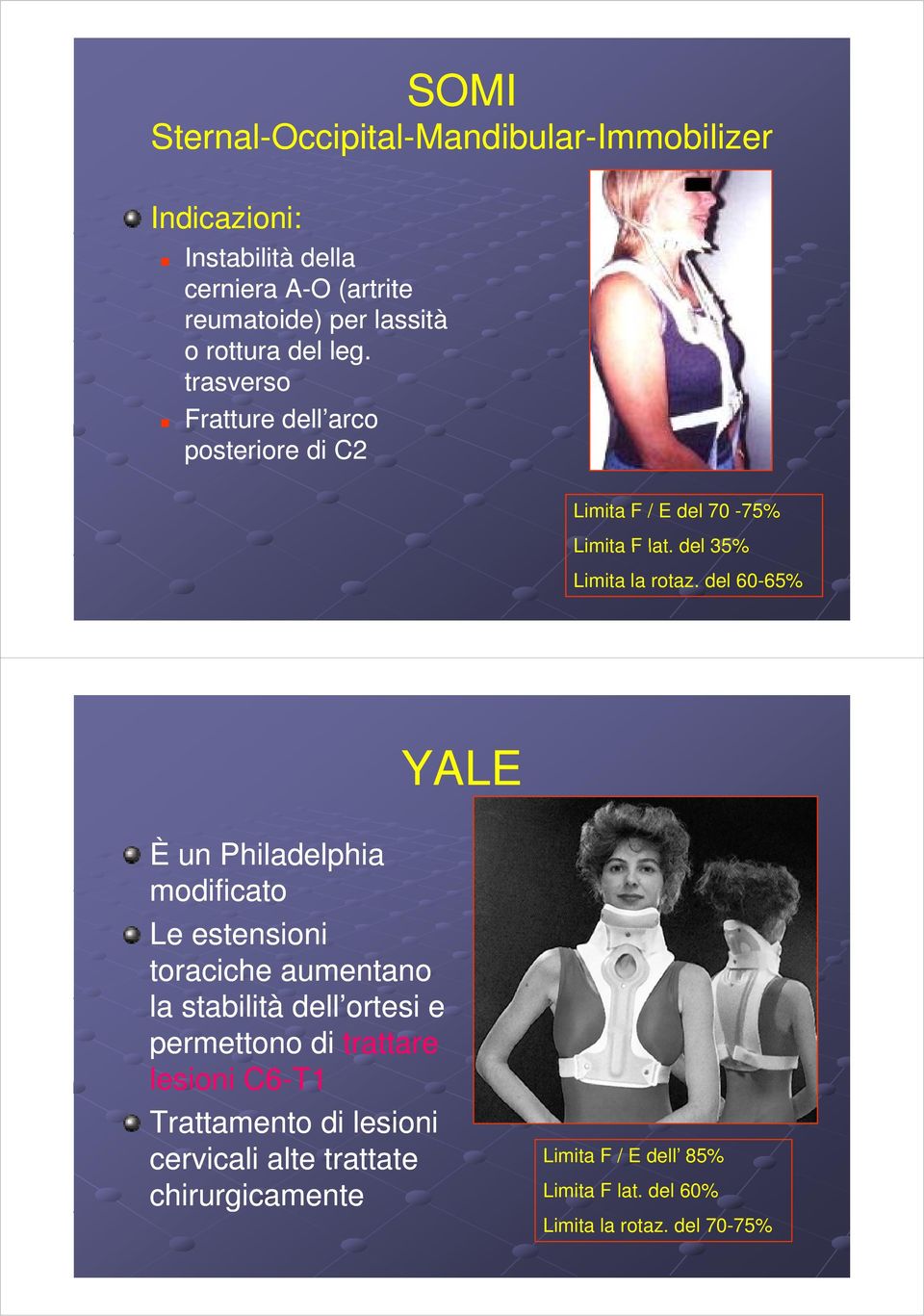 del 60-65% YALE È un Philadelphia modificato Le estensioni toraciche aumentano la stabilità dell ortesi e permettono di trattare