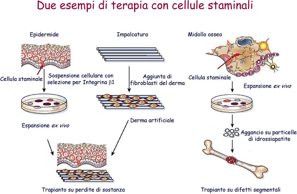 derma Cellula staminale Espansione ex vivo Espansione ex vivo Derma artificiale Aggancio su