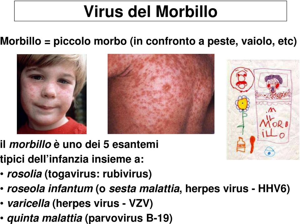 rosolia (togavirus: rubivirus) roseola infantum (o sesta malattia, herpes
