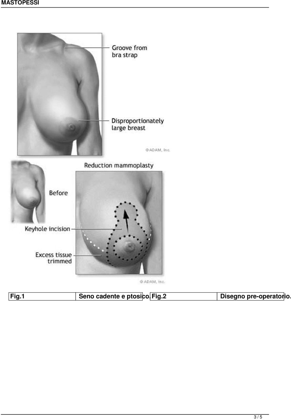 ptosico.fig.