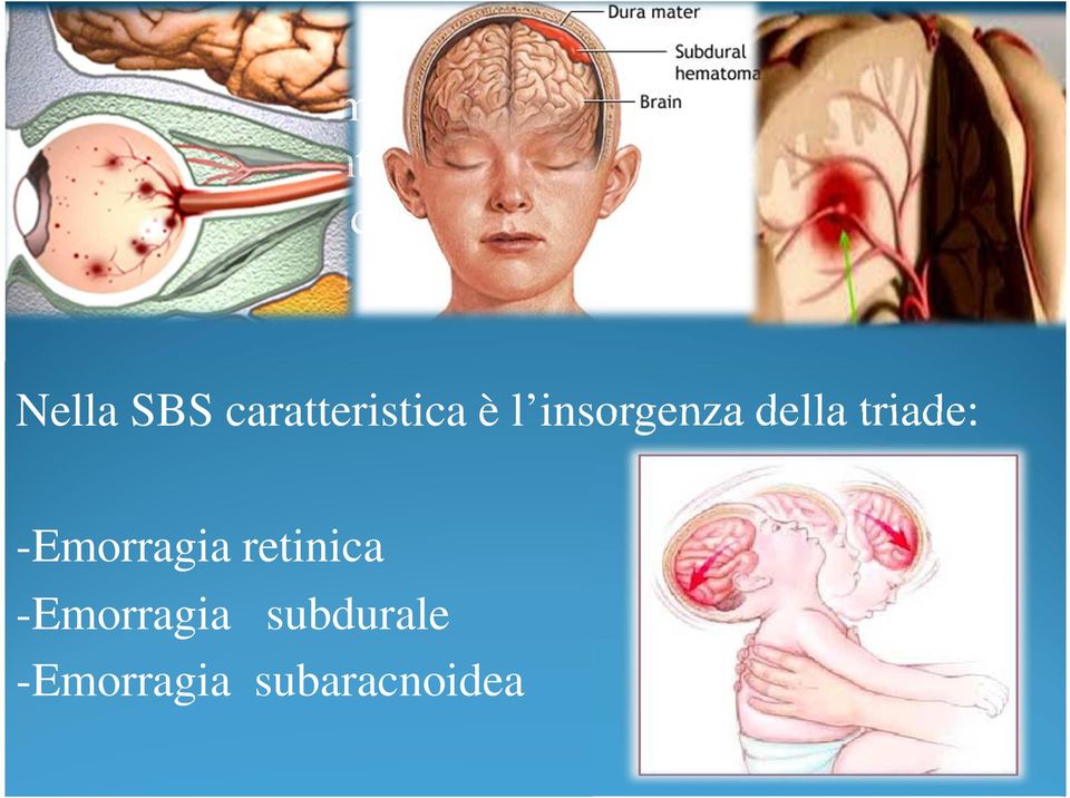 e possibile edema cerebrale.