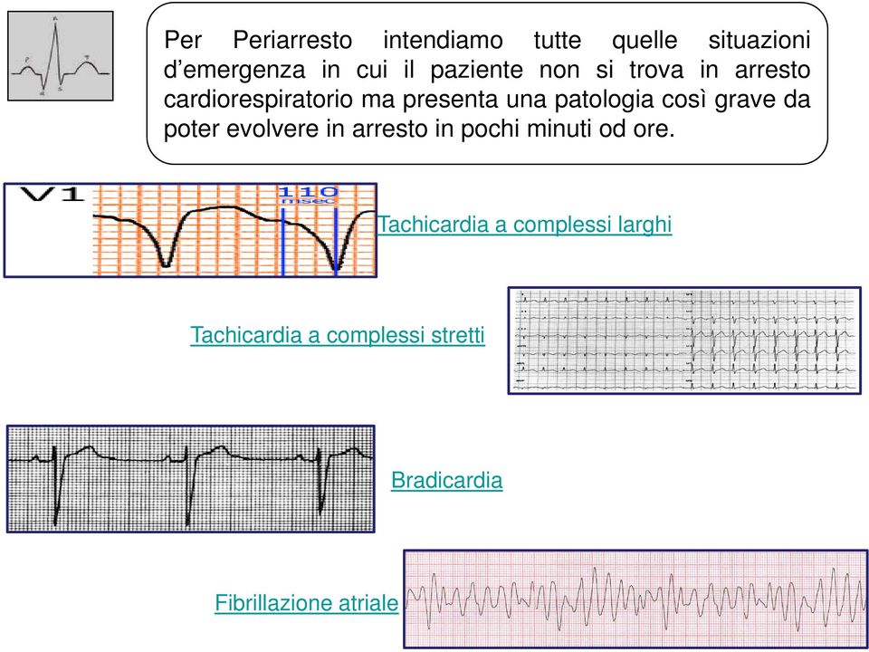 così grave da poter evolvere in arresto in pochi minuti od ore.